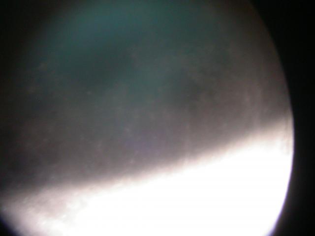Receding Eclipse with Blue/Green glow